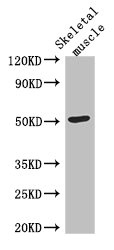 TUBG2 / Tubulin Gamma 2 Antibody - Western Blot Positive WB detected in: Mouse skeletal muscle tissue All lanes: TUBG2 antibody at 3µg/ml Secondary Goat polyclonal to rabbit IgG at 1/50000 dilution Predicted band size: 52 kDa Observed band size: 52 kDa