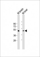 TUBG2 / Tubulin Gamma 2 Antibody - All lanes: Anti-gamma Tubulin Antibody at 1:2000 dilution Lane 1: Mouse brain lysate Lane 2: Mouse liver lysate Lysates/proteins at 20 µg per lane. Secondary Goat Anti-Rabbit IgG, (H+L), Peroxidase conjugated at 1/10000 dilution. Predicted band size: 51 kDa Blocking/Dilution buffer: 5% NFDM/TBST.