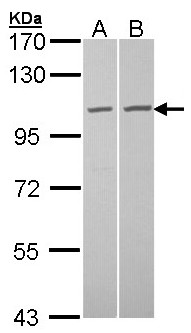 TUBGCP2 / GCP2 Antibody - Sample (30 ug of whole cell lysate). A: A431 , B: Hela. 7.5% SDS PAGE. TUBGCP2 / GCP2 antibody diluted at 1:1000.