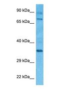TUBGCP4 Antibody - Western blot of GCP4 Antibody with human 721_B Whole Cell lysate.  This image was taken for the unconjugated form of this product. Other forms have not been tested.