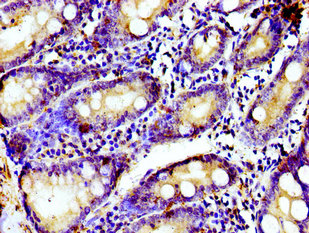 TUBGCP4 Antibody - Immunohistochemistry image of paraffin-embedded human small intestine tissue at a dilution of 1:100