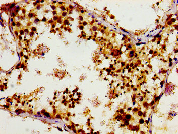 TUBGCP4 Antibody - Immunohistochemistry image of paraffin-embedded human testis tissue at a dilution of 1:100