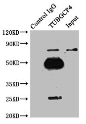 TUBGCP4 Antibody