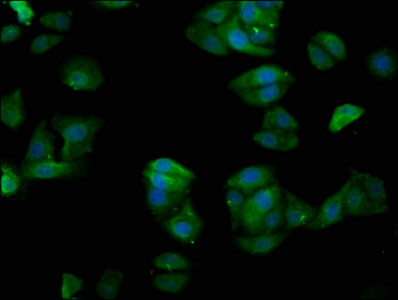 TUBGCP4 Antibody - Immunofluorescence staining of HepG2 cells with TUBGCP4 Antibody at 1:200, counter-stained with DAPI. The cells were fixed in 4% formaldehyde, permeabilized using 0.2% Triton X-100 and blocked in 10% normal Goat Serum. The cells were then incubated with the antibody overnight at 4°C. The secondary antibody was Alexa Fluor 488-congugated AffiniPure Goat Anti-Rabbit IgG(H+L).