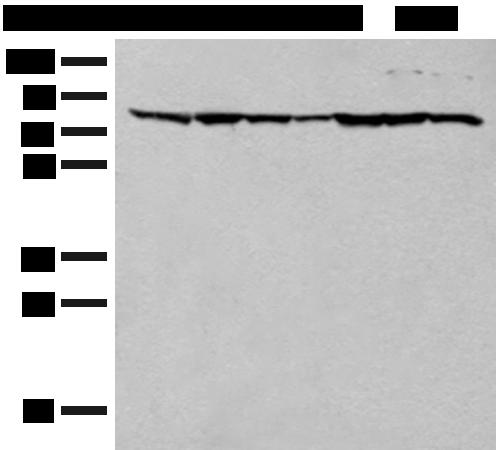 TUBGCP4 Antibody - Western blot analysis of HT-29 NIH/3T3 231 Hela RAW264.7 K562 and LOVO cell lysates  using TUBGCP4 Polyclonal Antibody at dilution of 1:300