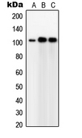 TUBGCP5 / GPC5 Antibody - Western blot analysis of GPC5 expression in Jurkat (A); IMR32 (B); HeLa (C) whole cell lysates.
