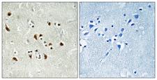 TUBGCP6 / GCP6 Antibody - Immunohistochemistry analysis of paraffin-embedded human brain tissue, using TUBGCP6 Antibody. The picture on the right is blocked with the synthesized peptide.