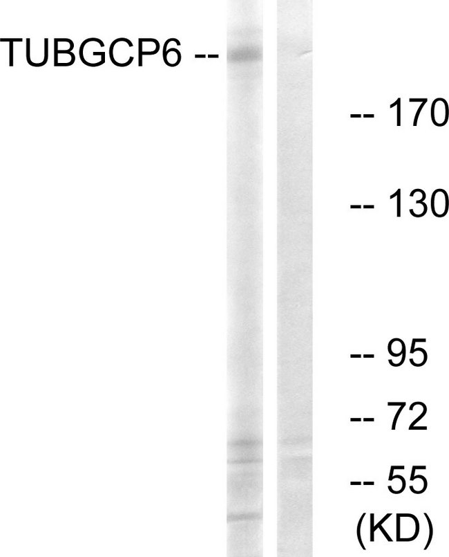 TUBGCP6 / GCP6 Antibody - Western blot analysis of lysates from COLO cells, using TUBGCP6 Antibody. The lane on the right is blocked with the synthesized peptide.