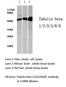 Tubulin Beta 1+2+3+5+6+8 Antibody - Western blot of Tubulin beta 1/2/3/5/6/8 pAb in extracts from HeLa cells, mouse brain and rat liver tissues.
