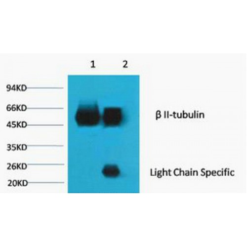 Tubulin Beta 2 Antibody - Immunoprecipitation of beta II tubulin antibody