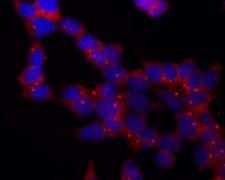 Tubulin Gamma Antibody - gamma Tubulin Antibody in Immunofluorescence (IF)