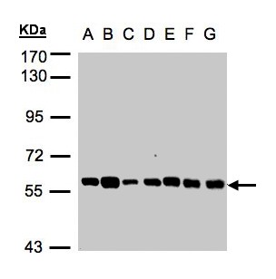 TULP1 Antibody - Sample (30 ug whole cell lysate). A:293T, B: A431 , C: H1299, D: HeLa S3 , E: Hep G2 . F: MOLT4 . G: Raji . 7.5% SDS PAGE. TULP1 antibody diluted at 1:1000