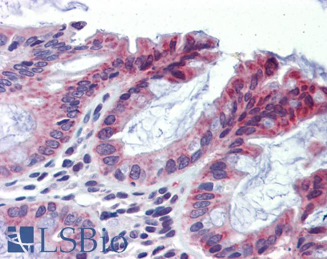 TULP2 Antibody - Anti-TULP2 antibody IHC of human colon. Immunohistochemistry of formalin-fixed, paraffin-embedded tissue after heat-induced antigen retrieval. Antibody concentration 5 ug/ml.  This image was taken for the unconjugated form of this product. Other forms have not been tested.