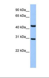 TULP3 Antibody - Fetal muscle lysate. Antibody concentration: 1.0 ug/ml. Gel concentration: 12%.  This image was taken for the unconjugated form of this product. Other forms have not been tested.