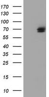 TULP3 Antibody - HEK293T cells were transfected with the pCMV6-ENTRY control (Left lane) or pCMV6-ENTRY TULP3 (Right lane) cDNA for 48 hrs and lysed. Equivalent amounts of cell lysates (5 ug per lane) were separated by SDS-PAGE and immunoblotted with anti-TULP3.
