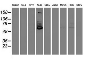 TULP3 Antibody - Western blot of extracts (35 ug) from 9 different cell lines by using anti-TULP3 monoclonal antibody.