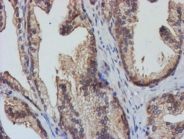 TULP3 Antibody - IHC of paraffin-embedded Human prostate tissue using anti-TULP3 mouse monoclonal antibody.