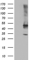 TULP3 Antibody - HEK293T cells were transfected with the pCMV6-ENTRY control (Left lane) or pCMV6-ENTRY TULP3 (Right lane) cDNA for 48 hrs and lysed. Equivalent amounts of cell lysates (5 ug per lane) were separated by SDS-PAGE and immunoblotted with anti-TULP3.