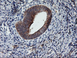 TULP3 Antibody - IHC of paraffin-embedded Human endometrium tissue using anti-TULP3 mouse monoclonal antibody.