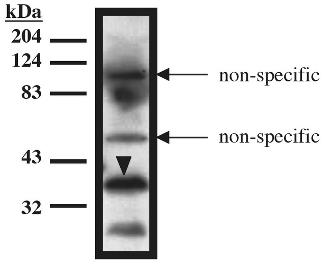 TUP1 Antibody - Western blot of TUP1 antibody on recombinant TUP1 protein (amino acids 1-200) expressed in Mav108 cells.