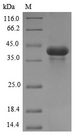 Acrosin Protein - (Tris-Glycine gel) Discontinuous SDS-PAGE (reduced) with 5% enrichment gel and 15% separation gel.