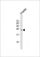 TUSC1 Antibody - Anti-TUSC1 Antibody (C-Term) at 1:1000 dilution + human testis lysate Lysates/proteins at 20 ug per lane. Secondary Goat Anti-Rabbit IgG, (H+L), Peroxidase conjugated at 1:10000 dilution. Predicted band size: 23 kDa. Blocking/Dilution buffer: 5% NFDM/TBST.