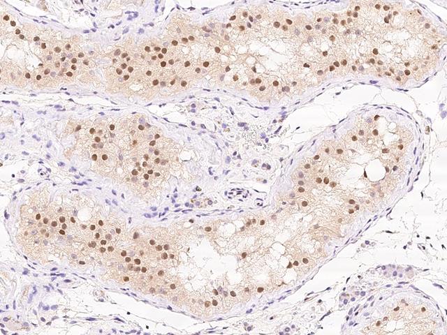 TUSC1 Antibody - Immunochemical staining of human TUSC1 in human testis with rabbit polyclonal antibody at 1:100 dilution, formalin-fixed paraffin embedded sections.
