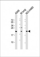 TUSC1 Antibody - All lanes: Anti-TUSC1 Antibody (N-Term) at 1:2000 dilution Lane 1: A549 whole cell lysate Lane 2: mouse lung lysate Lane 3: NCI-H460 whole cell lysate Lysates/proteins at 20 µg per lane. Secondary Goat Anti-Rabbit IgG, (H+L), Peroxidase conjugated at 1/10000 dilution. Predicted band size: 23 kDa Blocking/Dilution buffer: 5% NFDM/TBST.