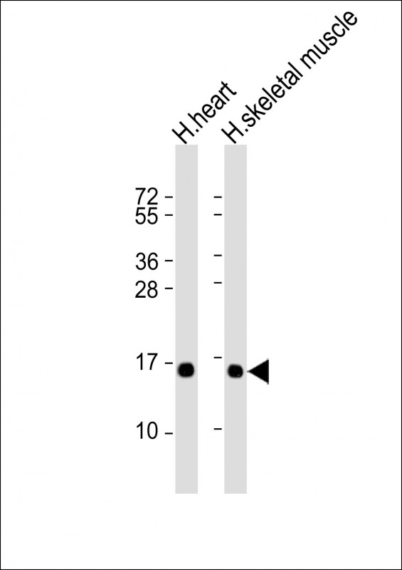 TUSC2 / FUS1 Antibody - All lanes: Anti-TUSC2 Antibody at 1:2000 dilution. Lane 1: human heart lysate. Lane 2: human skeletal muscle lysate Lysates/proteins at 20 ug per lane. Secondary Goat Anti-mouse IgG, (H+L), Peroxidase conjugated at 1:10000 dilution. Predicted band size: 12 kDa. Blocking/Dilution buffer: 5% NFDM/TBST.
