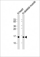 TUSC2 / FUS1 Antibody - All lanes: Anti-TUSC2 Antibody at 1:2000 dilution. Lane 1: human heart lysate. Lane 2: human skeletal muscle lysate Lysates/proteins at 20 ug per lane. Secondary Goat Anti-mouse IgG, (H+L), Peroxidase conjugated at 1:10000 dilution. Predicted band size: 12 kDa. Blocking/Dilution buffer: 5% NFDM/TBST.