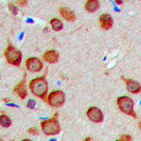 TUSC2 / FUS1 Antibody - Immunohistochemical analysis of Fusion 1 staining in human brain formalin fixed paraffin embedded tissue section. The section was pre-treated using heat mediated antigen retrieval with sodium citrate buffer (pH 6.0). The section was then incubated with the antibody at room temperature and detected using an HRP-conjugated compact polymer system. DAB was used as the chromogen. The section was then counterstained with hematoxylin and mounted with DPX.