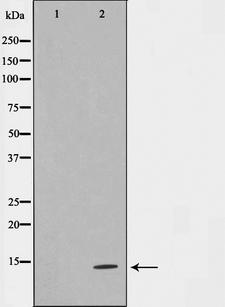 TUSC2 / FUS1 Antibody - Western blot analysis on HeLa cell lysates using TUSC2 antibody. The lane on the left is treated with the antigen-specific peptide.