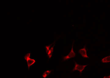 TUSC2 / FUS1 Antibody - Staining HeLa cells by IF/ICC. The samples were fixed with PFA and permeabilized in 0.1% Triton X-100, then blocked in 10% serum for 45 min at 25°C. The primary antibody was diluted at 1:200 and incubated with the sample for 1 hour at 37°C. An Alexa Fluor 594 conjugated goat anti-rabbit IgG (H+L) Ab, diluted at 1/600, was used as the secondary antibody.