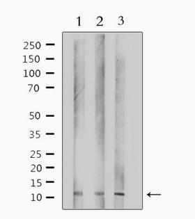 TUSC2 / FUS1 Antibody - Western blot analysis of extracts of various samples using TUSC2 antibody. Lane 1: HepG2; Lane 2: 293; Lane 3: mouse lung;
