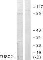 TUSC2 / FUS1 Antibody - Western blot analysis of extracts from HeLa cells, using TUSC2 antibody.