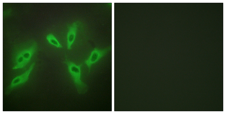 TUSC3 Antibody - Immunofluorescence analysis of HeLa cells using TUSC3 Antibody. The picture on the right is blocked with the synthesized peptide.