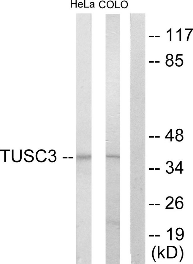TUSC3 Antibody - Western blot analysis of lysates from COLO205 and HeLa cells, using TUSC3 Antibody. The lane on the right is blocked with the synthesized peptide.