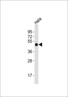 TUSC3 Antibody - Anti-TUSC3 Antibody at 1:1000 dilution + HeLa whole cell lysates Lysates/proteins at 20 ug per lane. Secondary Goat Anti-Rabbit IgG, (H+L),Peroxidase conjugated at 1/10000 dilution Predicted band size : 40 kDa Blocking/Dilution buffer: 5% NFDM/TBST.