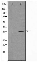 TUSC3 Antibody - Western blot of COLO205 cell lysate using TUSC3 Antibody