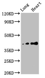 TUSC3 Antibody - Western Blot Positive WB detected in: Rat lung tissue, Rat heart tissue All Lanes: TUSC3 antibody at 4.7µg/ml Secondary Goat polyclonal to rabbit IgG at 1/50000 dilution Predicted band size: 40 KDa Observed band size: 40 KDa