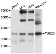 TUSC3 Antibody - Western blot analysis of extracts of various cell lines, using TUSC3 antibody at 1:3000 dilution. The secondary antibody used was an HRP Goat Anti-Rabbit IgG (H+L) at 1:10000 dilution. Lysates were loaded 25ug per lane and 3% nonfat dry milk in TBST was used for blocking. An ECL Kit was used for detection and the exposure time was 10s.