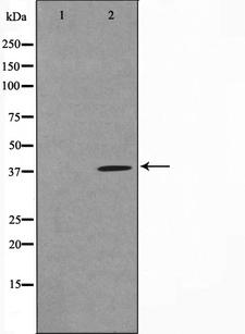 TUSC3 Antibody - Western blot analysis on COLO205 cell lysates using TUSC3 antibody. The lane on the left is treated with the antigen-specific peptide.