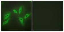 TUSC3 Antibody - Peptide - + Immunofluorescence analysis of HeLa cells, using TUSC3 antibody.