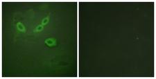 TUSC5 Antibody - Immunofluorescence analysis of HeLa cells, using TUSC5 Antibody. The picture on the right is blocked with the synthesized peptide.