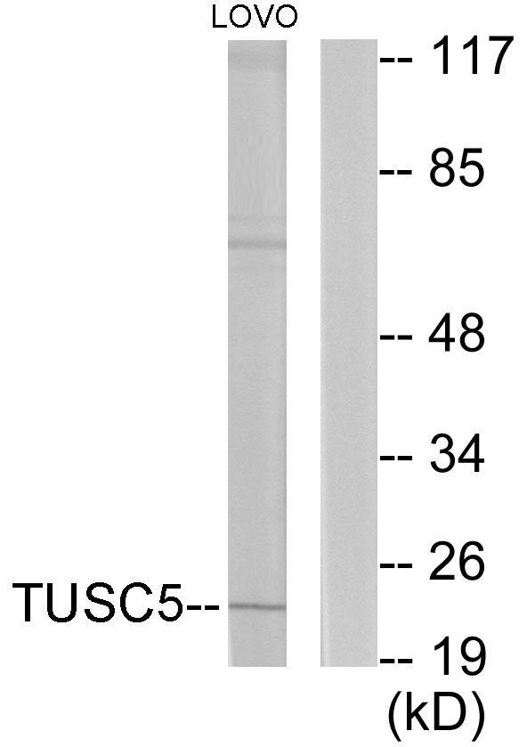 TUSC5 Antibody - Western blot analysis of lysates from LOVO cells, using TUSC5 Antibody. The lane on the right is blocked with the synthesized peptide.