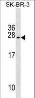 TUSC5 Antibody - TUSC5 Antibody western blot of SK-BR-3 cell line lysates (35 ug/lane). The TUSC5 antibody detected the TUSC5 protein (arrow).