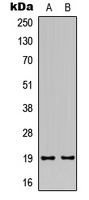 TUSC5 Antibody - Western blot analysis of TUSC5 expression in human heart (A); rat heart (B) whole cell lysates.