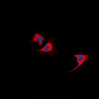 TUSC5 Antibody - Immunofluorescent analysis of TUSC5 staining in HeLa cells. Formalin-fixed cells were permeabilized with 0.1% Triton X-100 in TBS for 5-10 minutes and blocked with 3% BSA-PBS for 30 minutes at room temperature. Cells were probed with the primary antibody in 3% BSA-PBS and incubated overnight at 4 deg C in a humidified chamber. Cells were washed with PBST and incubated with a DyLight 594-conjugated secondary antibody (red) in PBS at room temperature in the dark. DAPI was used to stain the cell nuclei (blue).
