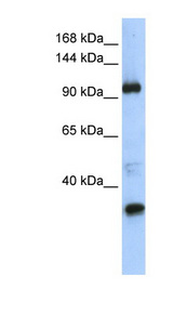 TUT1 Antibody - TUT1 antibody Western blot of Transfected 293T cell lysate. This image was taken for the unconjugated form of this product. Other forms have not been tested.
