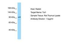 TUT1 Antibody -  This image was taken for the unconjugated form of this product. Other forms have not been tested.